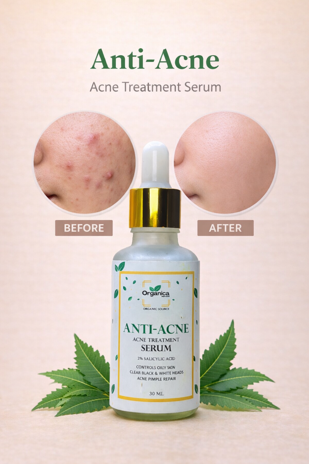 Organica Anti-Acne Serum